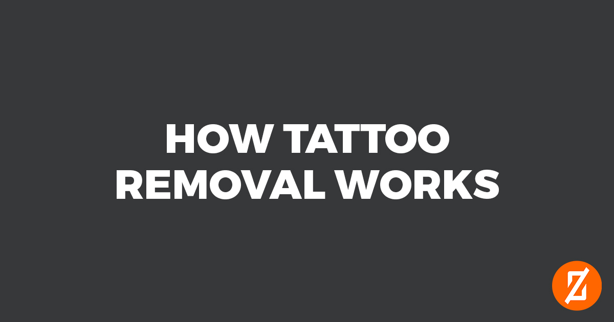 How Tattoo Removal Works | Laser Tattoo Removal Southampton